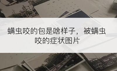 螨虫咬的包是啥样子，被螨虫咬的症状图片